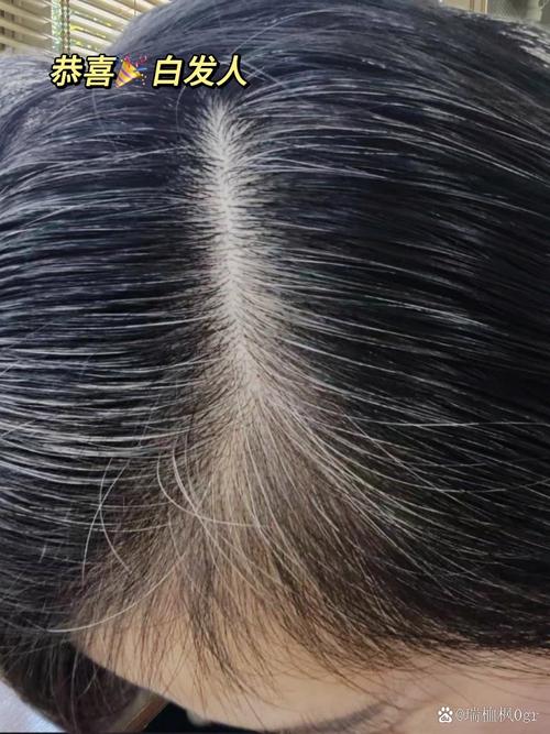 解锁头发亮泽密码：从根源焕发丝缕光芒