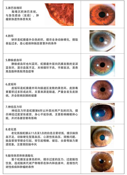 虹膜识别技术：生物特征识别的新篇章