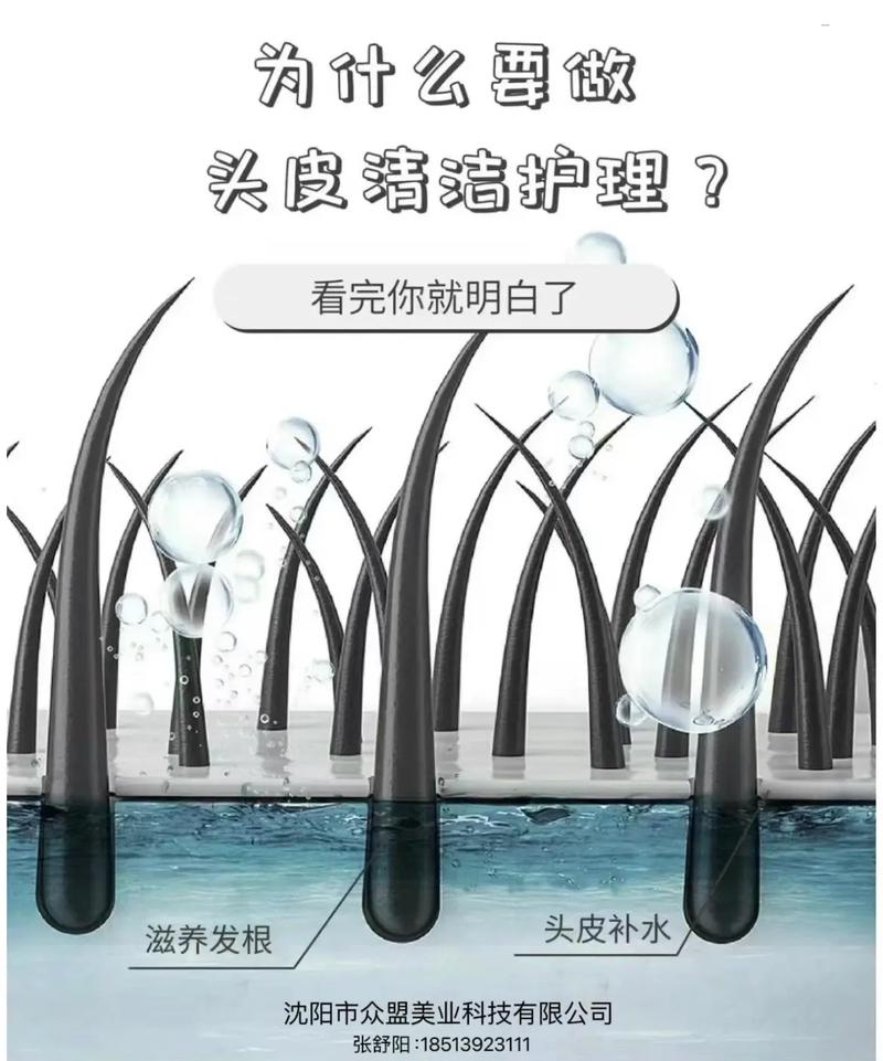 头发护理之头皮清洁频率：科学养护的关键