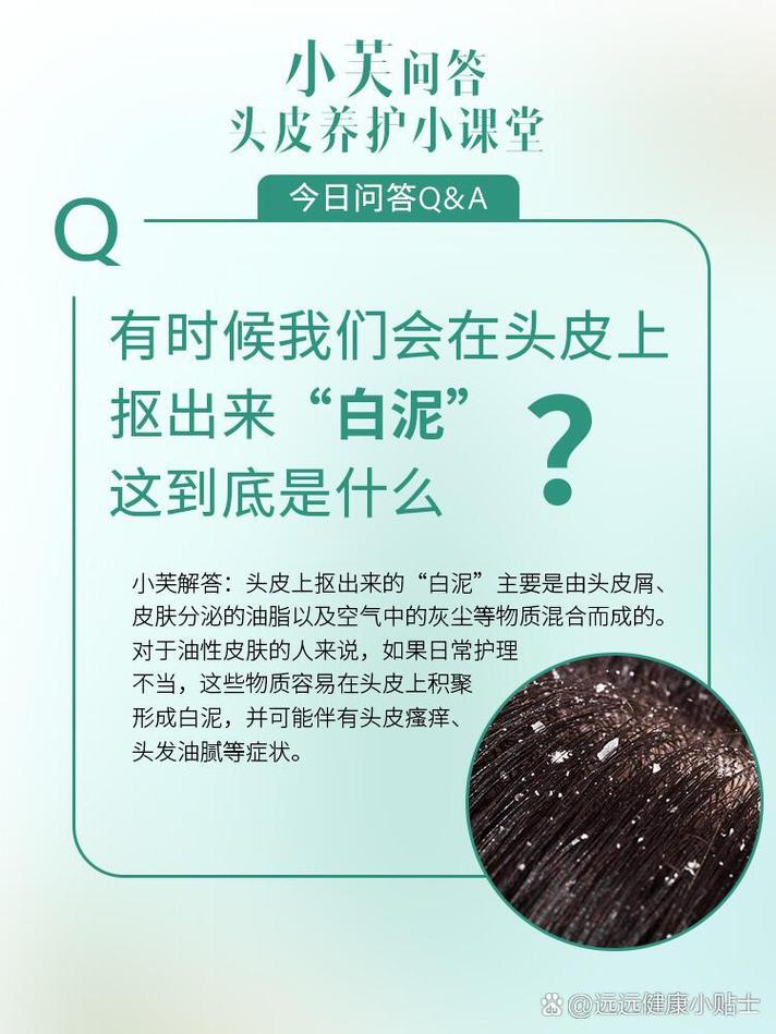头皮瘙痒的“幕后黑手”：全面解析头发护理中的头皮问题根源