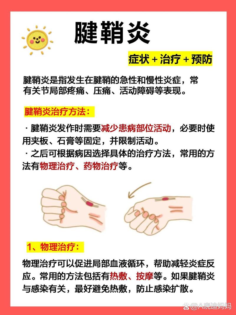 腱鞘炎：全面解析与治疗指南