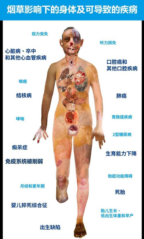 吸烟对皮肤的损害表现：一场肌肤的“灾难”