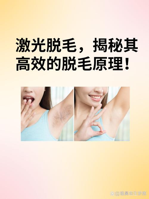 激光脱毛与光子脱毛：原理、效果及选择指南