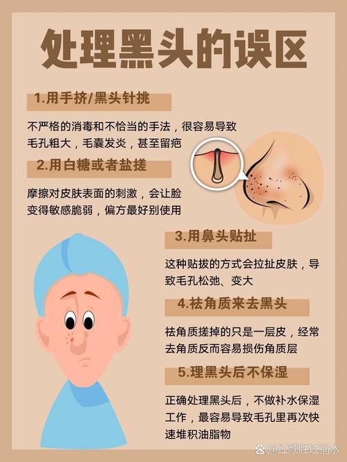 黑头清除窍门：告别“草莓鼻”，重拾肌肤光滑细腻