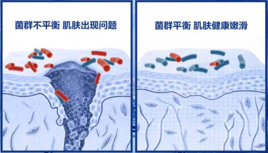 压力对皮肤的影响机制：揭示身心与肌肤的微妙联系