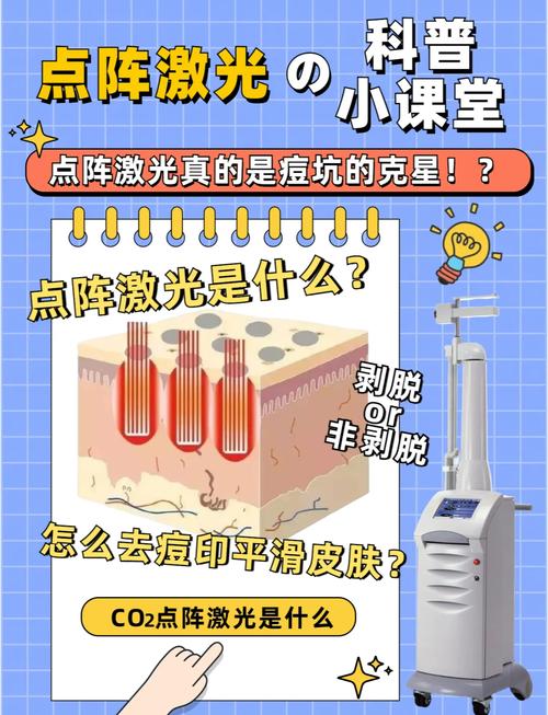 点阵激光治疗：原理与作用深度解析