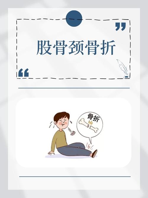 详细阅读:骨折:从预防到康复的全方位解析 骨折:从预防到康复的全方位解析