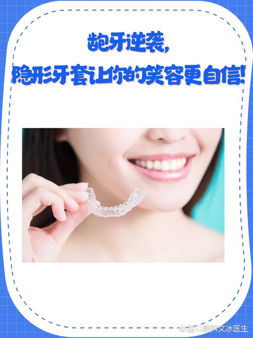 隐形矫正牙齿：悄然蜕变，绽放自信笑容