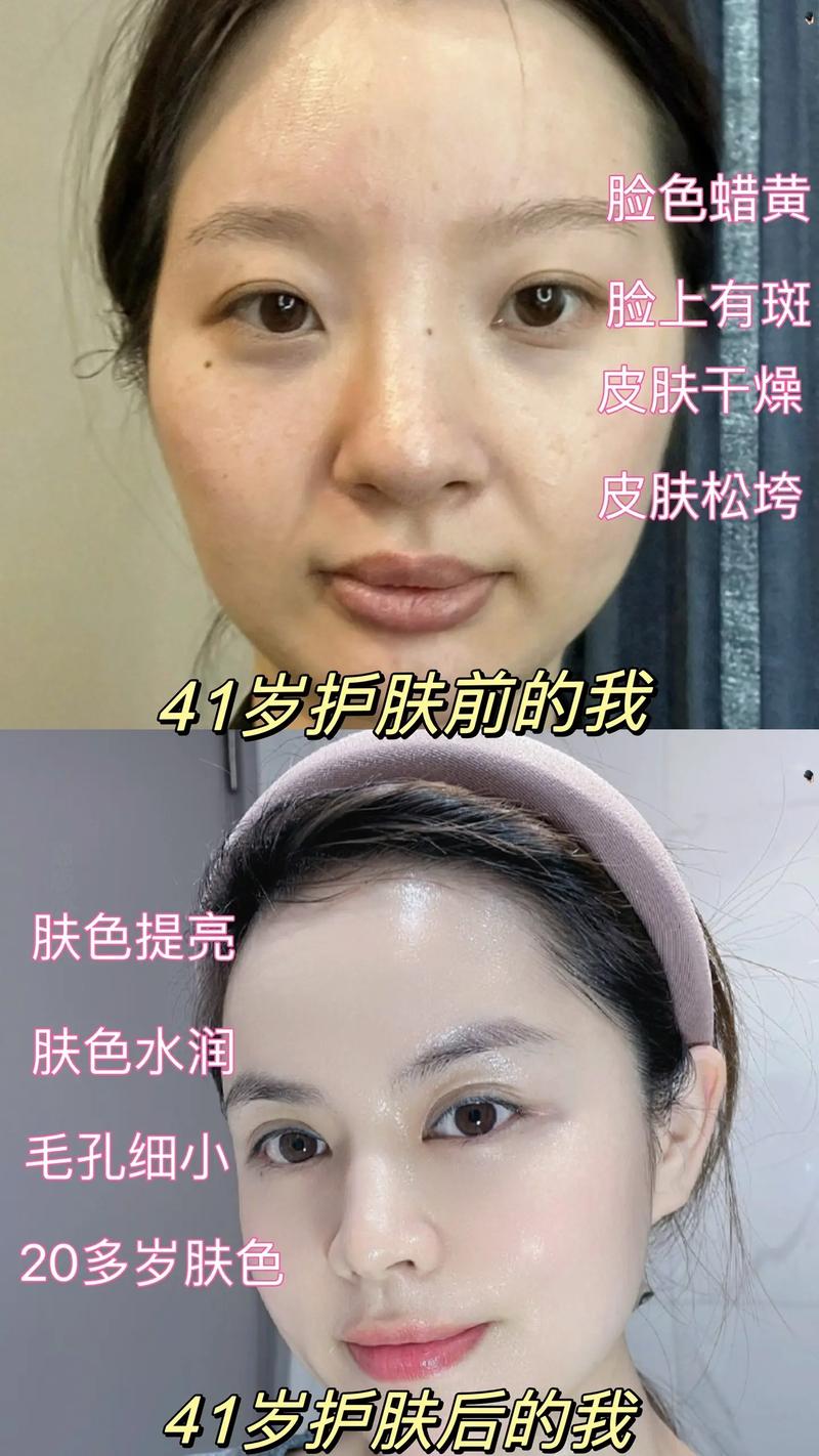 面部光泽度提升：焕发肌肤活力的奥秘
