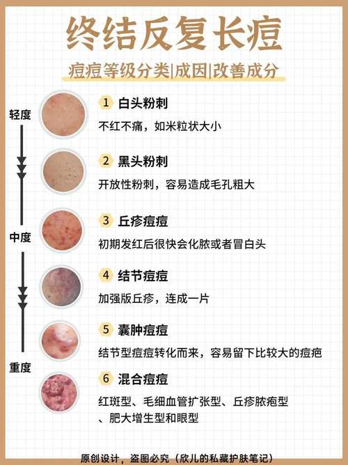 肌肤瑕疵改善：重拾肌肤光彩的全方位攻略
