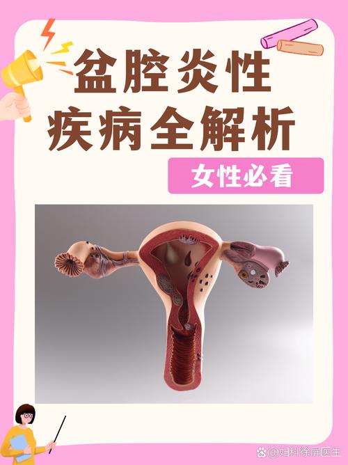 常见妇科疾病全解析：守护女性生殖健康