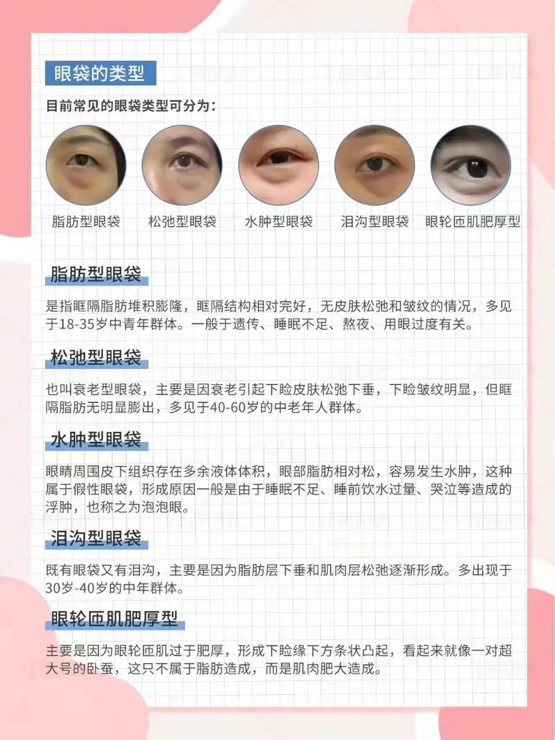 眼部眼袋消除全攻略：告别疲惫，重焕明眸光彩