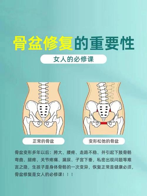 详细阅读:探秘产后骨盆修复带:重塑身材与健康的秘诀 探秘产后骨盆修复带:重塑身材与健康的秘诀