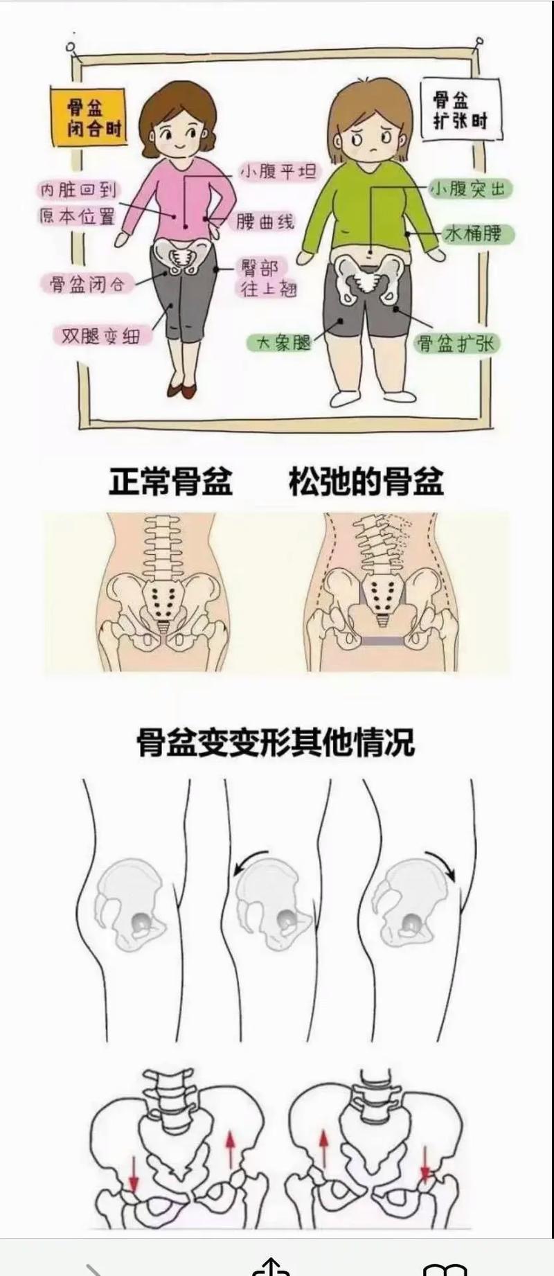 产后骨盆带：妈妈们的“身材救星”