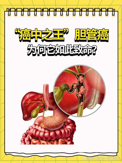 肿瘤：威胁生命健康的“隐形杀手”及其多面剖析