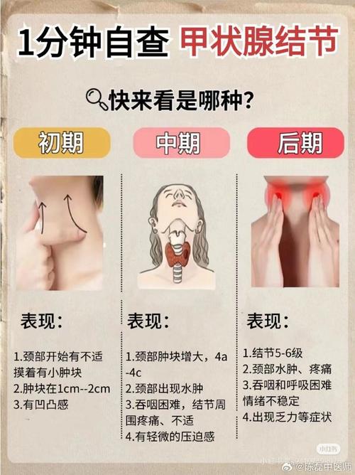 甲状腺疾病的全面解析