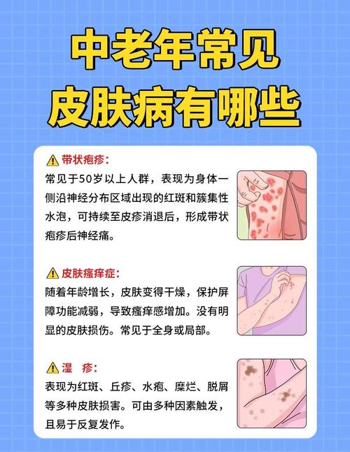 皮肤病：了解、预防与应对的全面指南
