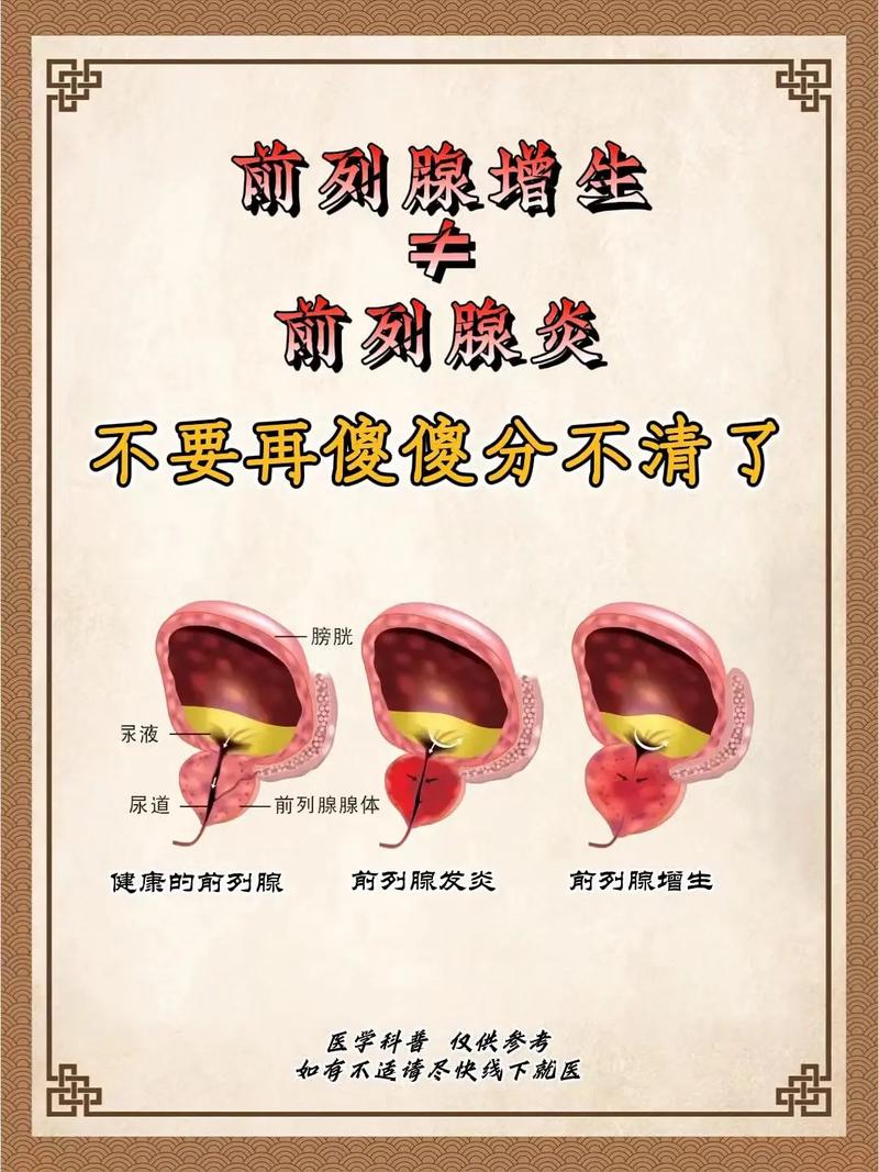 以下是关于前列腺炎治疗的一些常见方法：