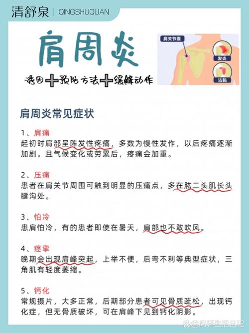 详细阅读:肩周炎的全面解析与应对策略 肩周炎的全面解析与应对策略