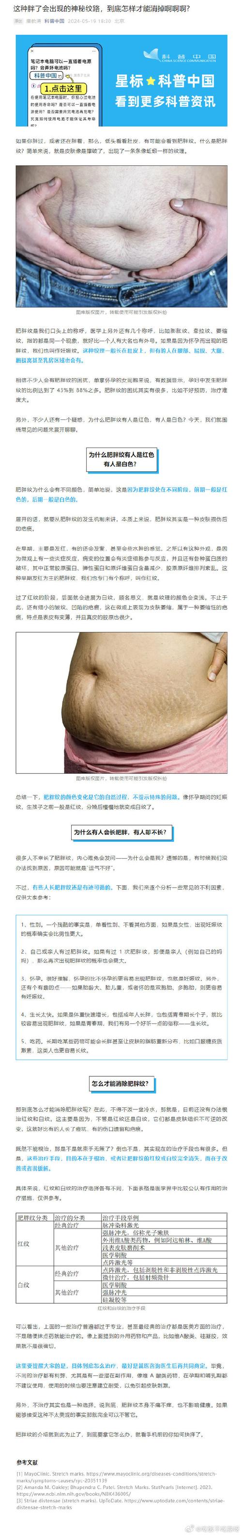 肥胖纹修复：重拾肌肤平滑的科学之路