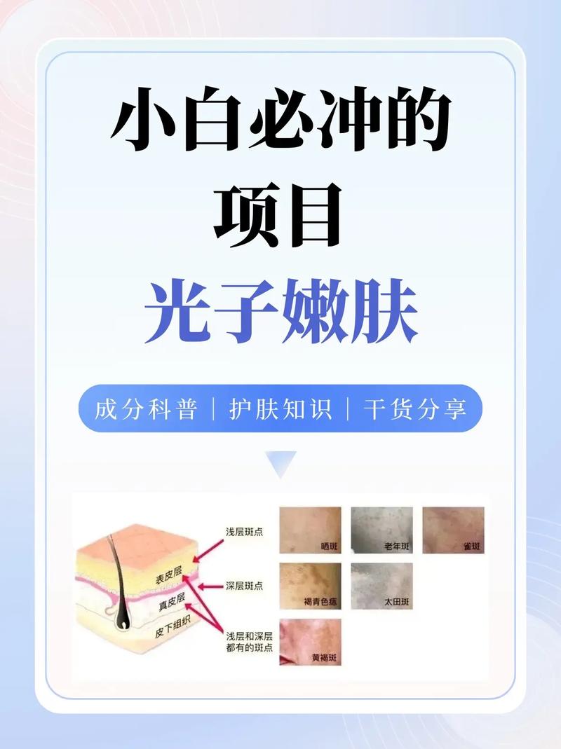 揭秘光子嫩肤：重拾年轻肌肤的科技魔法