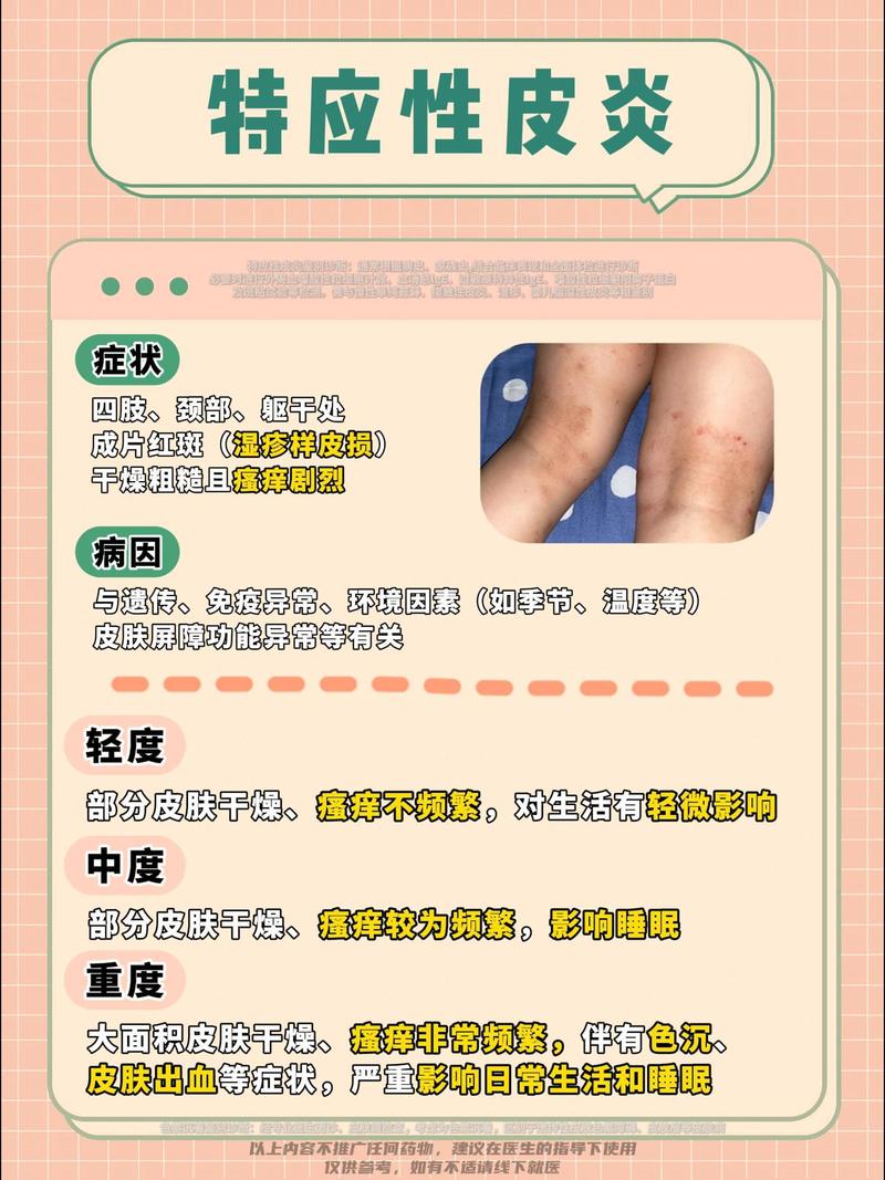 探秘皮炎：成因、症状、防治全解析，守护肌肤健康防线