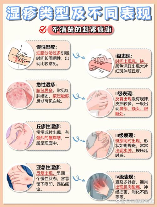 湿疹：了解与应对，守护肌肤健康