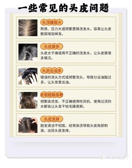 遗传性脱发与头皮护理全攻略：重拾秀发自信