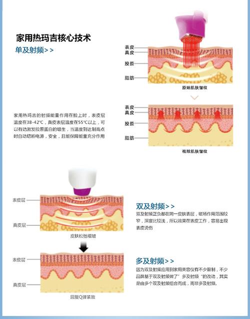 射频美容仪：原理与功效全解析