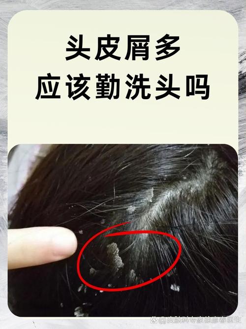 头皮瘙痒：多维度剖析与精准应对策略