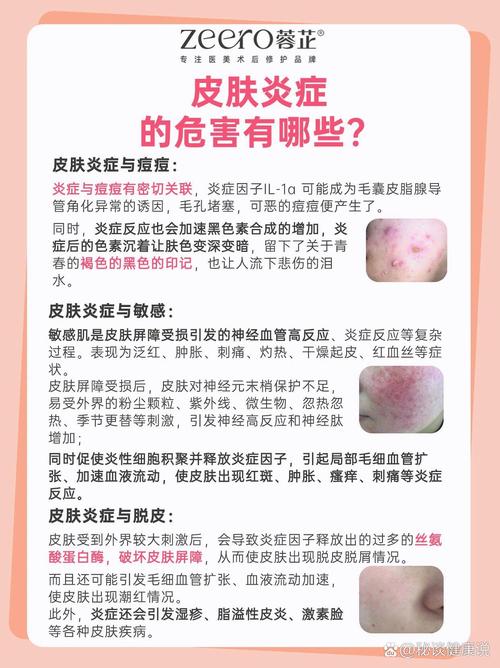 详细阅读:肌肤炎症的科学处理与护理指南 肌肤炎症的科学处理与护理指南