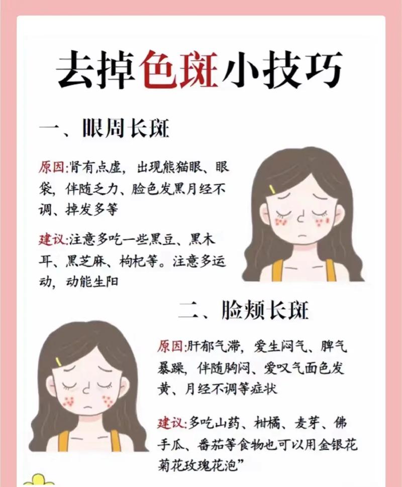 详细阅读:雀斑淡化攻略:全方位解析,助你重拾无瑕肌肤 雀斑淡化攻略:全方位解析,助你重拾无瑕肌肤