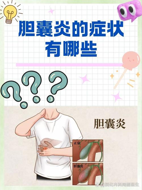胆囊炎