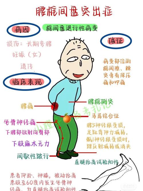 腰椎病：症状、原因及防治全解析