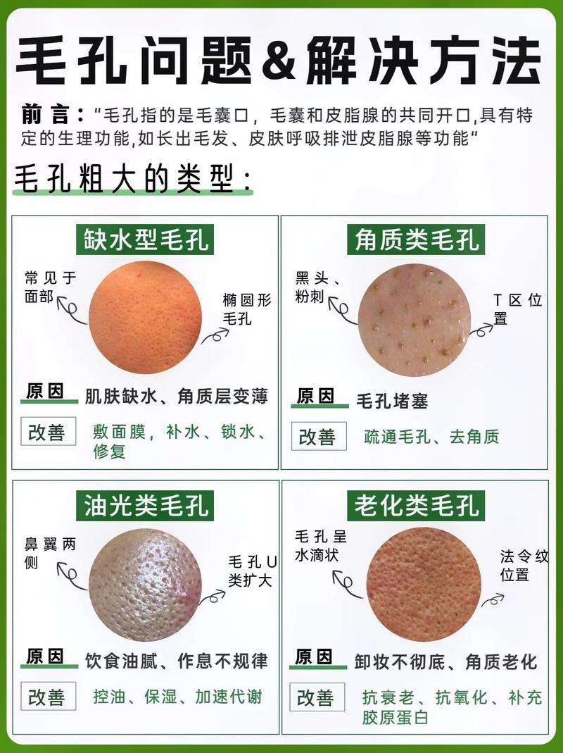 详细阅读:毛孔粗大原因剖析:探寻肌肤问题的深层根源 毛孔粗大原因剖析:探寻肌肤问题的深层根源
