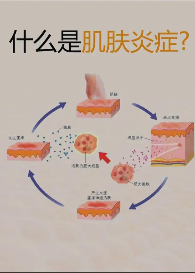 全面解析皮肤炎症的缓解之道：从诱因到科学护理
