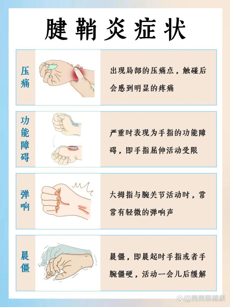 腱鞘炎的全面治疗方法