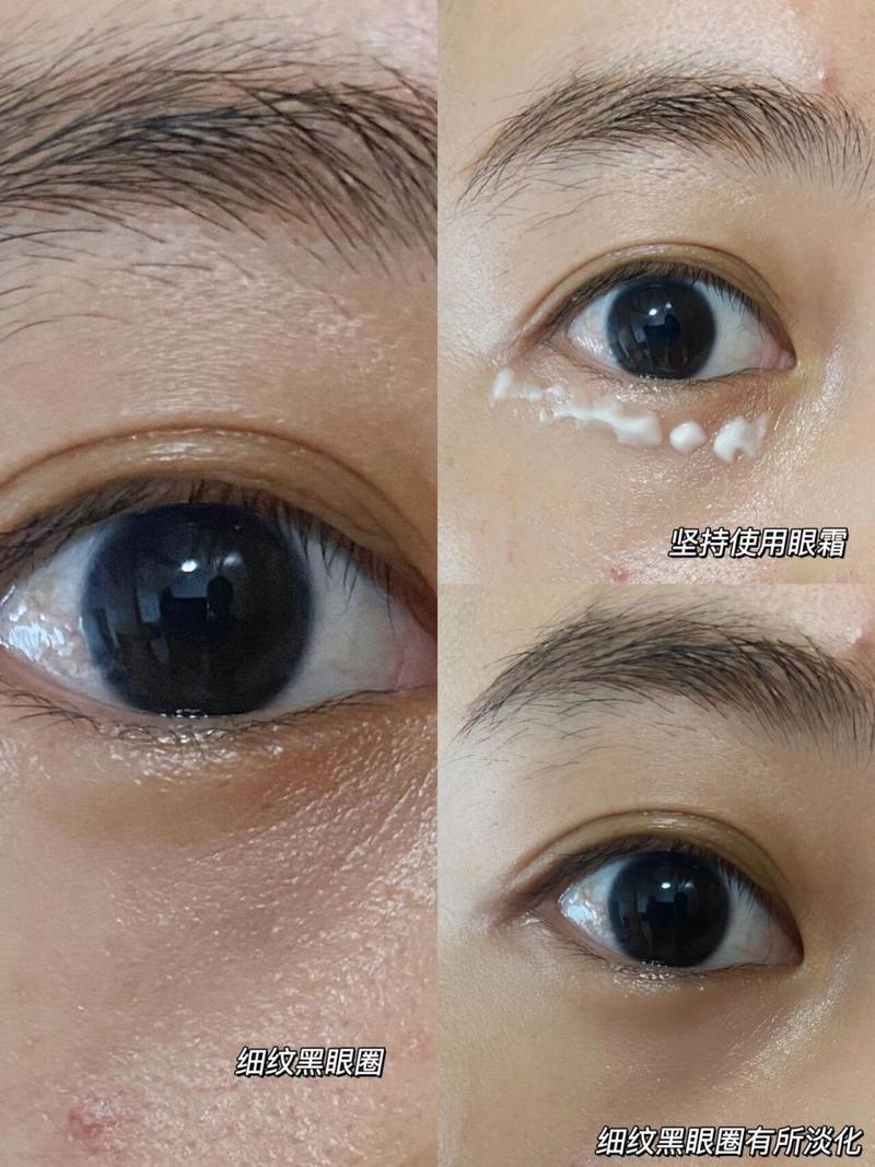 详细阅读:眼部细纹淡化:守护心灵之窗的年轻密码 眼部细纹淡化:守护心灵之窗的年轻密码