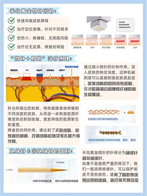 详细阅读:黄金微针抗衰紧致:重塑青春容颜的神奇之术 黄金微针抗衰紧致:重塑青春容颜的神奇之术