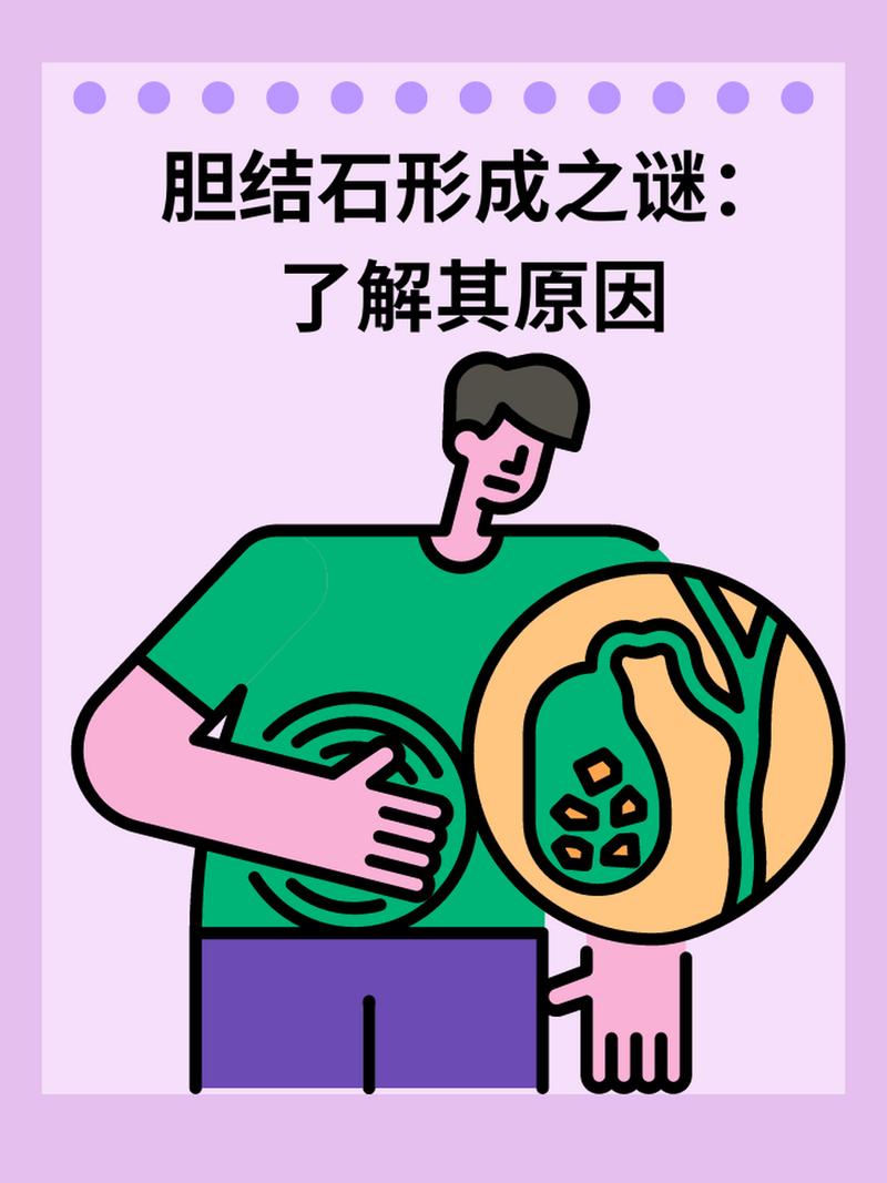 胆结石：隐藏的健康杀手，你了解多少？