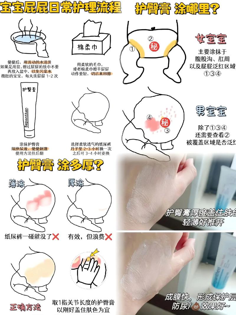 详细阅读:护臀膏的正确使用方法与注意事项 护臀膏的正确使用方法与注意事项