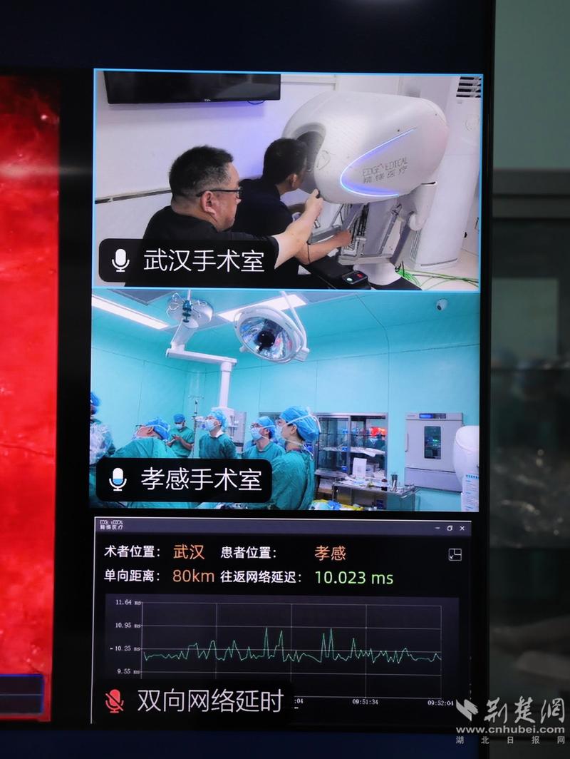 详细阅读:远程手术:医疗领域的革新之光 远程手术:医疗领域的革新之光