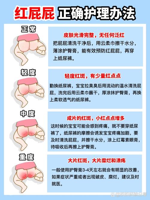 宝宝红屁屁护理全攻略：守护娇嫩肌肤，助力宝宝健康成长