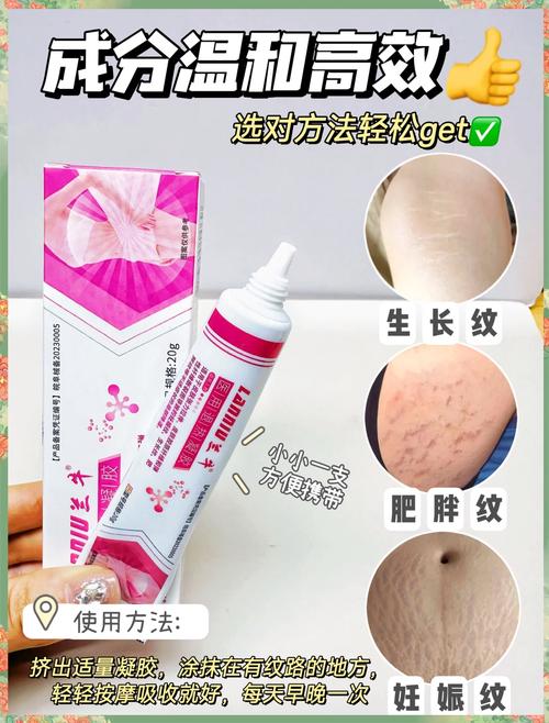 产后护理妊娠纹修复全攻略：精选产品助你重拾肌肤光滑