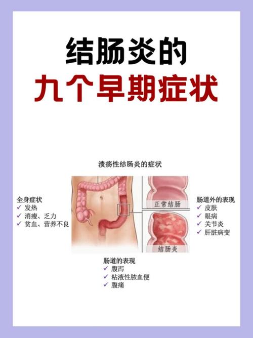 详细阅读:肠炎:病因、症状、诊断与治疗全解析 肠炎:病因、症状、诊断与治疗全解析