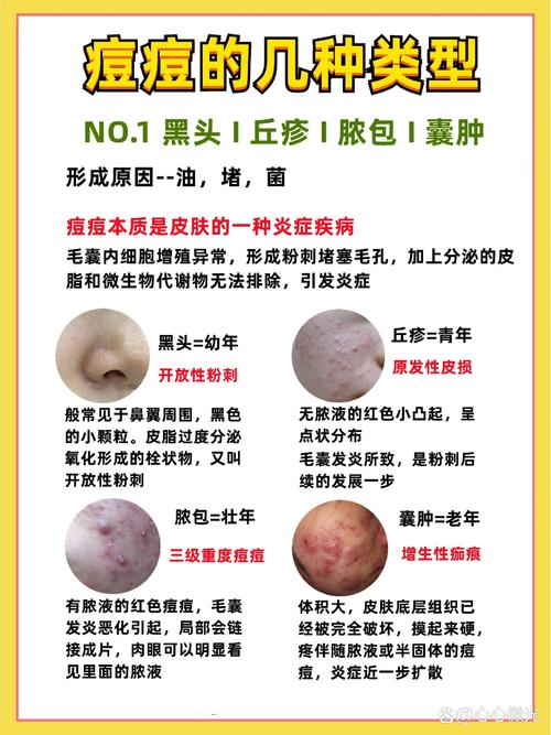 全面解析皮炎：成因、症状与科学应对策略