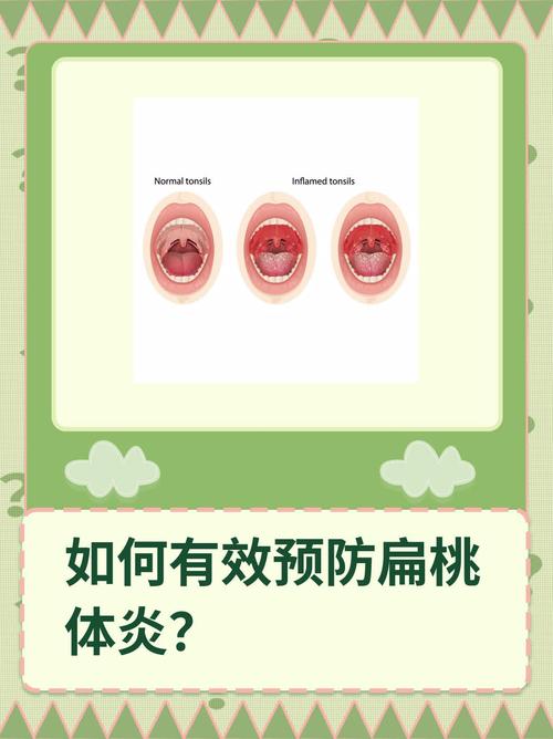 详细阅读:扁桃体炎防治:守护咽喉健康的全方位攻略 扁桃体炎防治:守护咽喉健康的全方位攻略