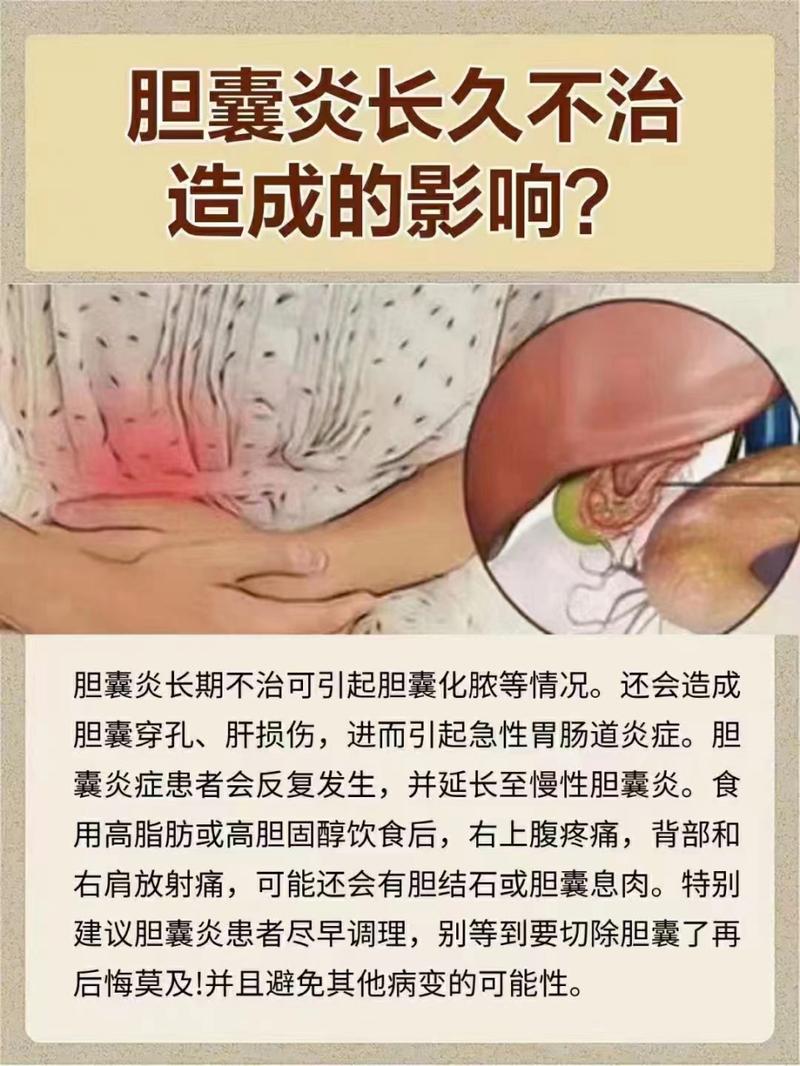 胆囊炎的治疗方法