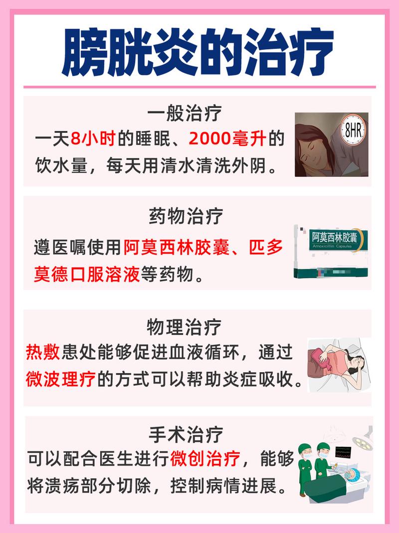 膀胱炎的治疗方法