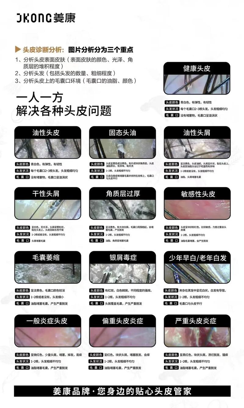 头发护理与头皮清洁产品深度解析：重拾秀发健康活力